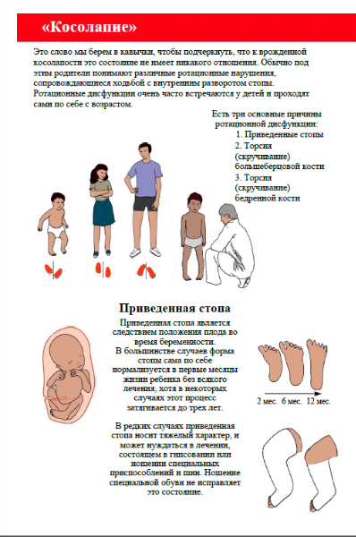 Косолапие у детей лечение в домашних условиях Косолапие у детей лечение в домашних условиях