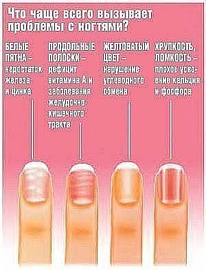 Продальные полоски на ногтях