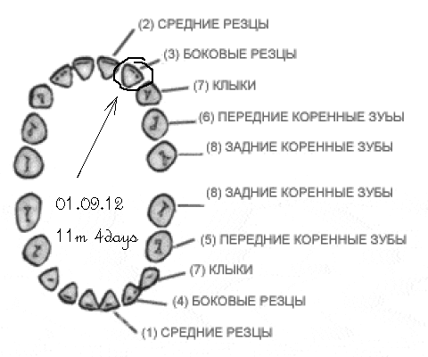 Глазной зуб где находится фото