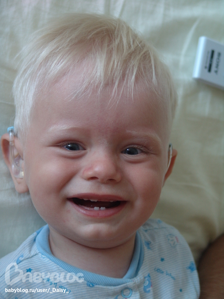 Видны все 5 зубиков