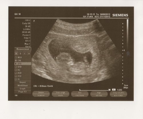 Живот беременной 12 недель фото