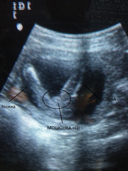 17 неделя беременности от зачатия: УЗИ плода, фото живота, что происходит с мамой и малышом