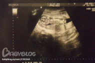 Фото УЗИ на 1 неделе беременности
