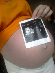 Фото УЗИ на 37 неделе беременности